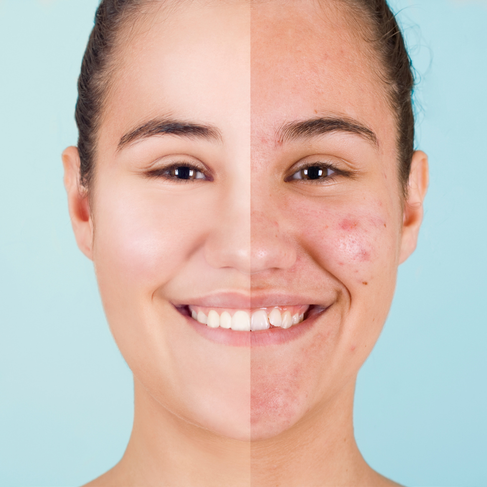 What Is Beef Tallow Skincare? The Ancient Ingredient Your Skin Has Been Craving