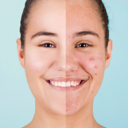 What Is Beef Tallow Skincare? The Ancient Ingredient Your Skin Has Been Craving